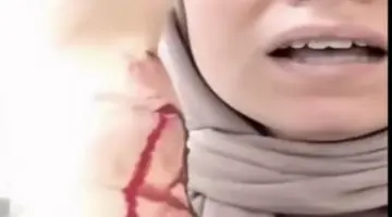 وزارة الصحة تصدر بيان رسمي بخصوص واقعة الاعتداء على الدكتورة سارة